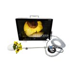 Portable All-in-One Medical Endoscope Camera System Endoscopy Machine for Laparoscopy Tower