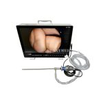 Portable All-in-One Medical Endoscope Camera System Endoscopy Machine for Laparoscopy Tower
