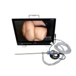 Portable All-in-One Medical Endoscope Camera System Endoscopy Machine for Laparoscopy Tower